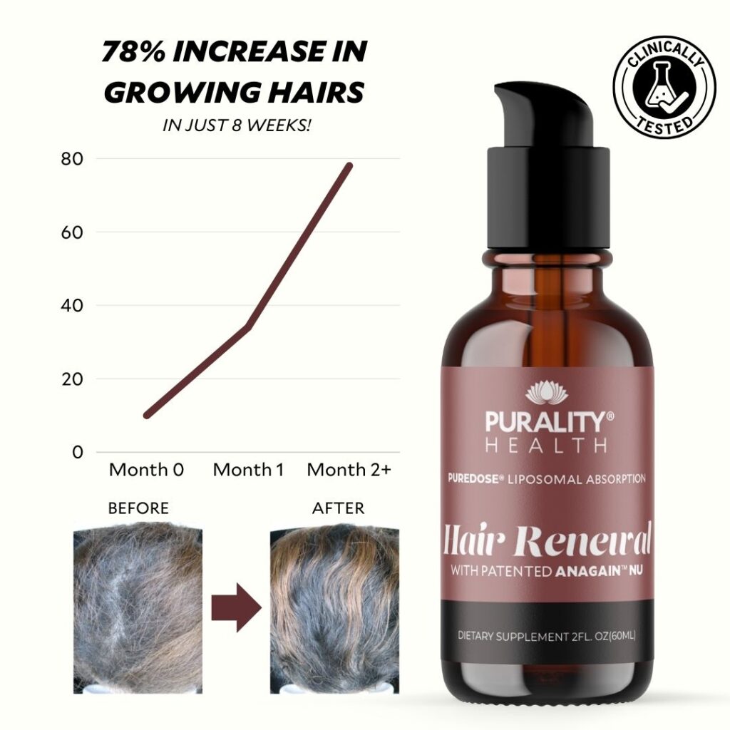 Honest review of Hair Renewal by Purality Health – a clinically tested liposomal hair supplement with AnaGain™ Nu that reduces hair loss and promotes thicker, fuller hair. Suitable for men and women.